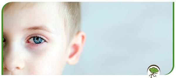 Pinkeye (Conjunctivitis) in Children Treatment Specialist in Winter Park, FL